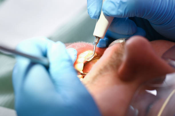 Best Chipped Tooth Repair Near Me  in Bowmansville, PA