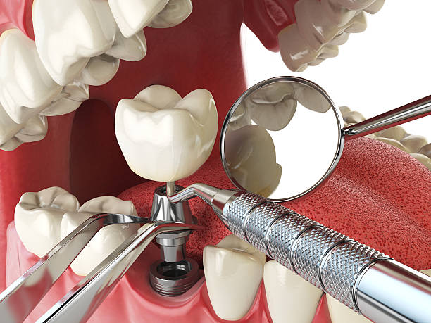 Best Root Canal Emergency Dentist  in Bowmansville, PA